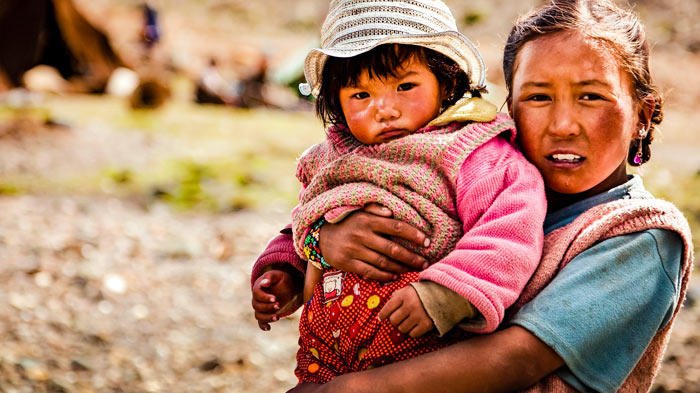 The local Tibetans get less affected by the sunburns.